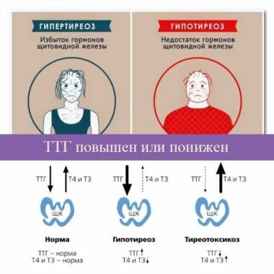 Симптомы и признаки